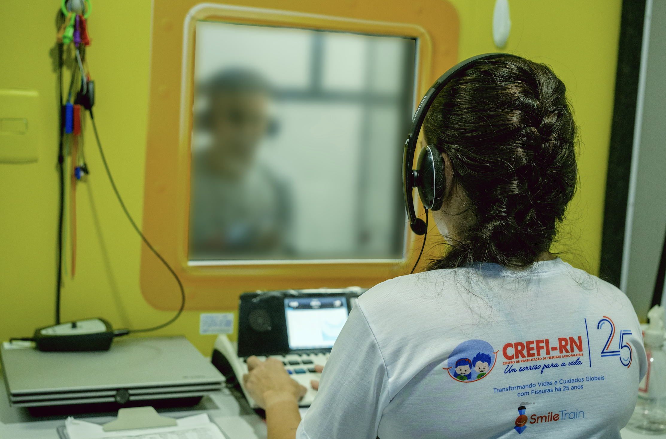 Hospital Infantil Varela Santiago promove ação para ampliar tratamento de fissuras labiopalatais no RN